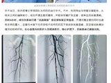 打通“活血隧道”，张洪哲博士团队助七旬老人“枯腿逢春”