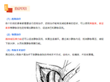 夏季露腿不好看，激光消融可消除“蚯蚓腿”