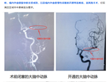 喜讯！我院获评广东省“防治卒中中心”单位