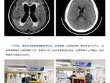 多科会诊显成效，抽丝剥茧救同胞