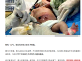 手术刀变“绣花针”，早产儿化危为安丨南方七院多学科协同成功为低体重早产儿行肠切除修补手术