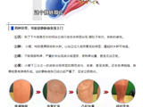 蚯蚓腿别大意，小心肺栓塞要了命！