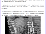 医疗技术丨“分离-消融-重建”！你见过这样的“拆弹专家”？