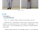 医疗技术丨当“歪脖子”畸形遇上外伤：两位“顶梁柱”的颈椎治疗之路