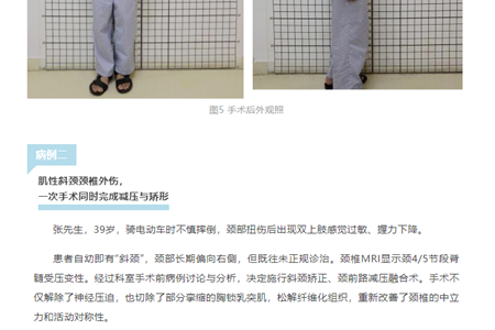 医疗技术丨当“歪脖子”畸形遇上外伤：两位“顶梁柱”的颈椎治疗之路